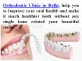 Delhi Dentist Implant Best Orthodontic Clinic in Delhi PowerPoint PPT Presentation