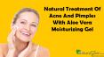 Natural Treatment Of Acne And Pimples With Aloe Vera Moisturizing Gel PowerPoint PPT Presentation
