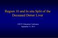 Region 10 and In situ Split of the Deceased Donor Liver PowerPoint PPT Presentation