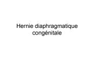 Hernie diaphragmatique cong