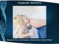 Cesarean%20Sections PowerPoint PPT Presentation