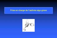 Prise en charge de l