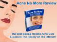 Acne Remedies And Acne Diet For Perfect Clear Skin PowerPoint PPT Presentation