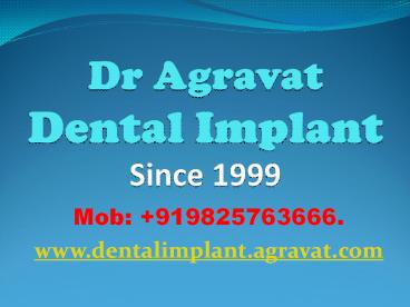 Dental Implants Ahmedabad India Affordable Best low costDental Implants India