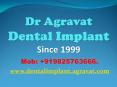 Dental Implants Ahmedabad India Affordable Best low costDental Implants India PowerPoint PPT Presentation