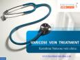 Varicose vein treatment  & SPIDER VEINS - Karishma Vein Clinic PowerPoint PPT Presentation