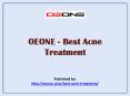 Best Acne Treatment PowerPoint PPT Presentation