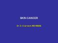SKIN CANCER PowerPoint PPT Presentation