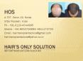 Get Hair Transplant clinic in Delhi NCR, call us @ 9650708899