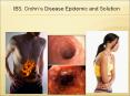 IBS, Crohn PowerPoint PPT Presentation