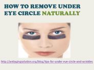 HOW TO REMOVE UNDER EYE CIRCLE NATURALLY