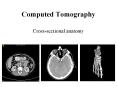 Computed Tomography PowerPoint PPT Presentation