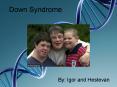 Down Syndrome PowerPoint PPT Presentation