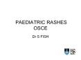 PAEDIATRIC RASHES OSCE PowerPoint PPT Presentation