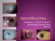Keratoplastika