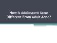 How Is Adolescent Acne Different From Adult Acne? PowerPoint PPT Presentation