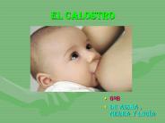 EL CALOSTRO