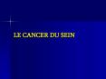 LE CANCER DU SEIN PowerPoint PPT Presentation