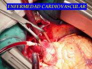 Diapositiva 1