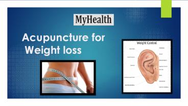 Acupuncture Mississauga (1)