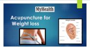 Acupuncture Mississauga (1)