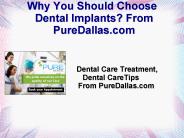 Why You Should Choose Dental Implants