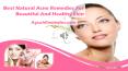 Best Natural Acne Remedies For Beautiful And Healthy Skin PowerPoint PPT Presentation