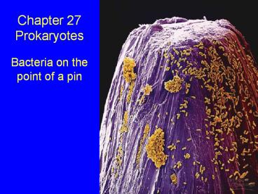 Chapter 27 Prokaryotes