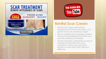 Revitol Scar Cream remover