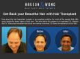 Get Back your Beautiful Hair with Hair Transplant PowerPoint PPT Presentation