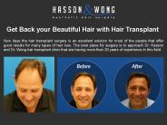 Get Back your Beautiful Hair with Hair Transplant