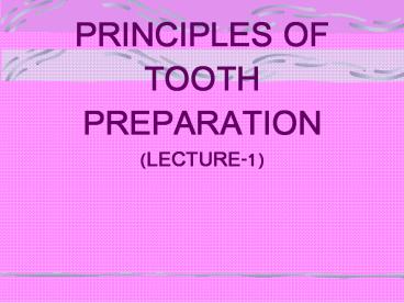 PRINCIPLES OF TOOTH PREPARATION (LECTURE-1)