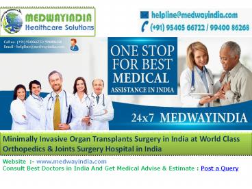 Best Organ Transplants Surgery Hospitals in India