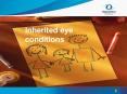 Inherited eye conditions PowerPoint PPT Presentation