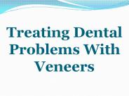 Treating Dental Problems With Veneers