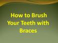 How to Brush Your Teeth with Braces PowerPoint PPT Presentation