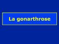 La gonarthrose PowerPoint PPT Presentation