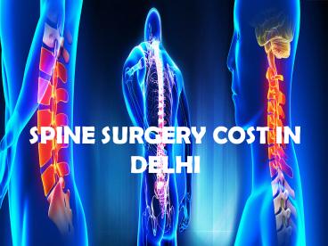 spine surgery in India