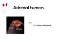Adrenal tumors PowerPoint PPT Presentation