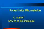 Polyarthrite Rhumato
