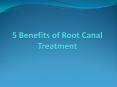 5 Benefits of Root Canal Treatment PowerPoint PPT Presentation