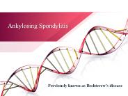 Ankylosing Spondylitis Treatments