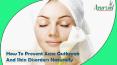 How To Prevent Acne Outbreak And Skin Disorders Naturally? PowerPoint PPT Presentation