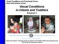 Visual Conditions in Infants and Toddlers Session 3 PowerPoint PPT Presentation