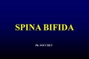 SPINA BIFIDA