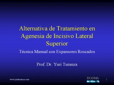 Alternativa de Tratamiento en Agenesia de Incisivo Lateral Superior