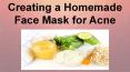 Face Masks for Acne PowerPoint PPT Presentation