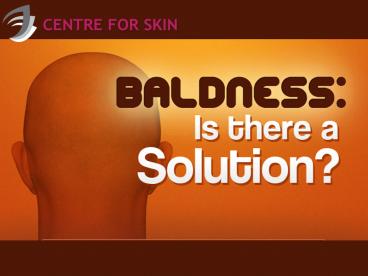 need hair transplantation