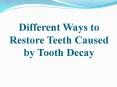 Different Ways to Restore Teeth Caused by Tooth Decay PowerPoint PPT Presentation