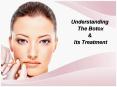 Botox Las Vegas PowerPoint PPT Presentation